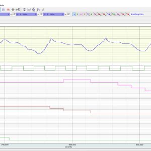 BioHarness Telemetry & Logging Systems
