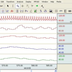 Noninvasive Blood Pressure Amplifier