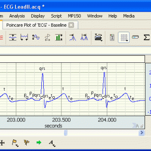ECG Electrocardiogram Analysis Software Module