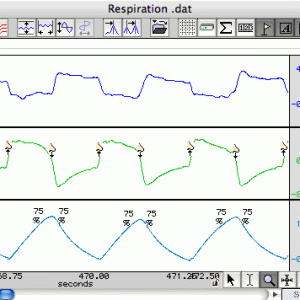 Respiration Analysis Software Module