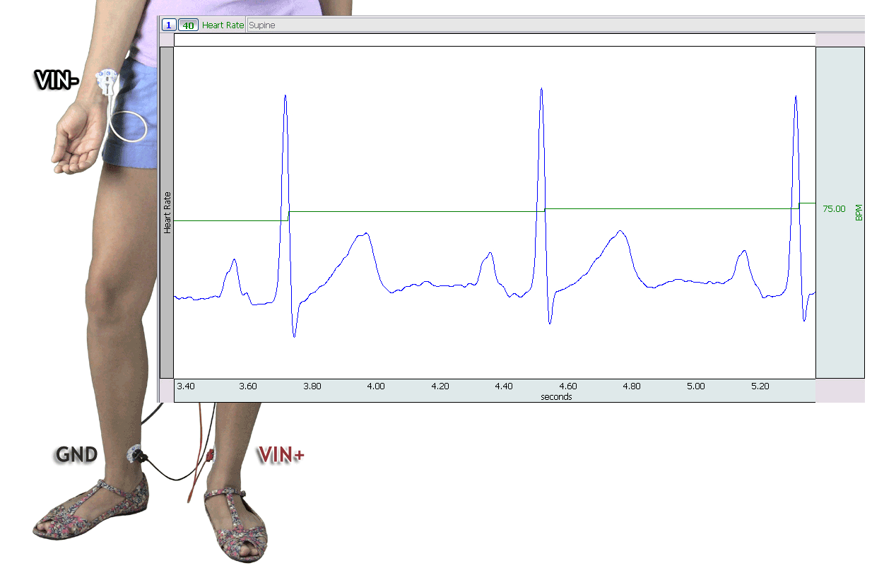 ECG Practical Lab for heart rate