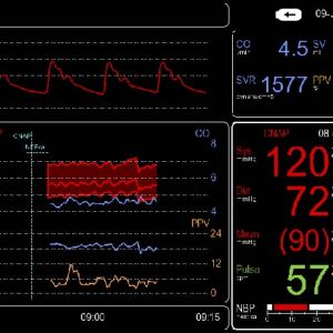 Noninvasive BP+Hemodynamics