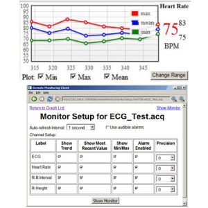 Remote Monitor Licensed feature for AcqKnowledge